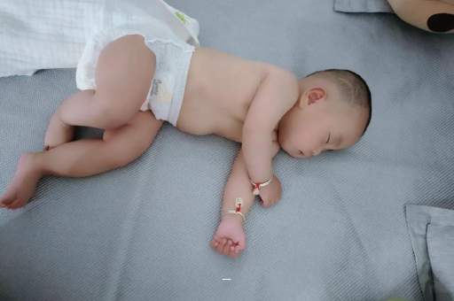 温岭宝宝脸上有白色斑块